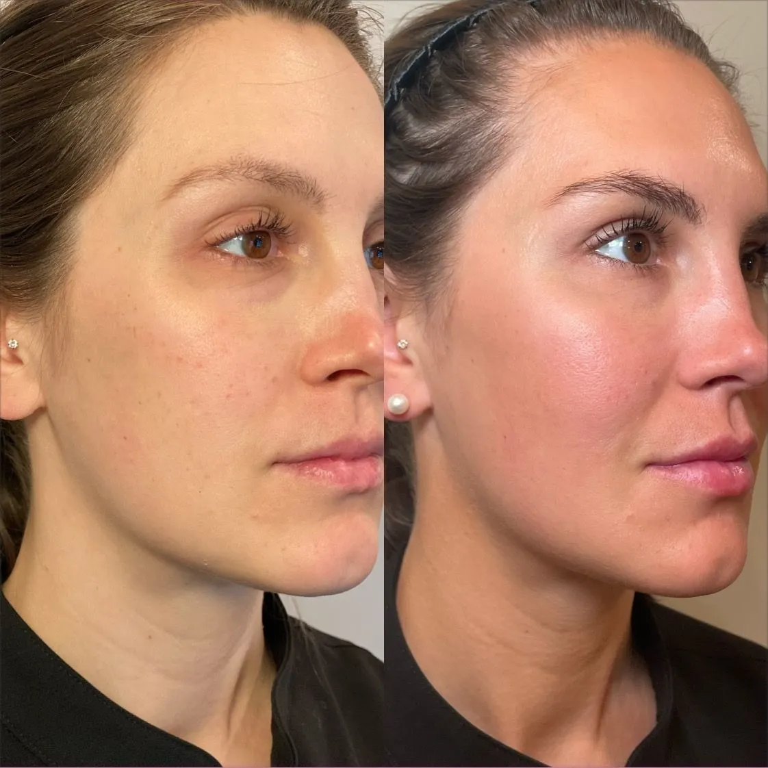 Vitamin Therapy Results